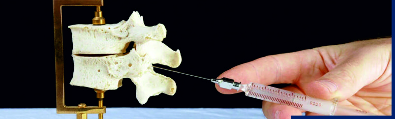 Steroid Injections for Spine Treatment